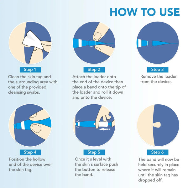 Skin Tag Removal Mole, Kit Automatic Mole Remover Tool with Cleansing Swabs